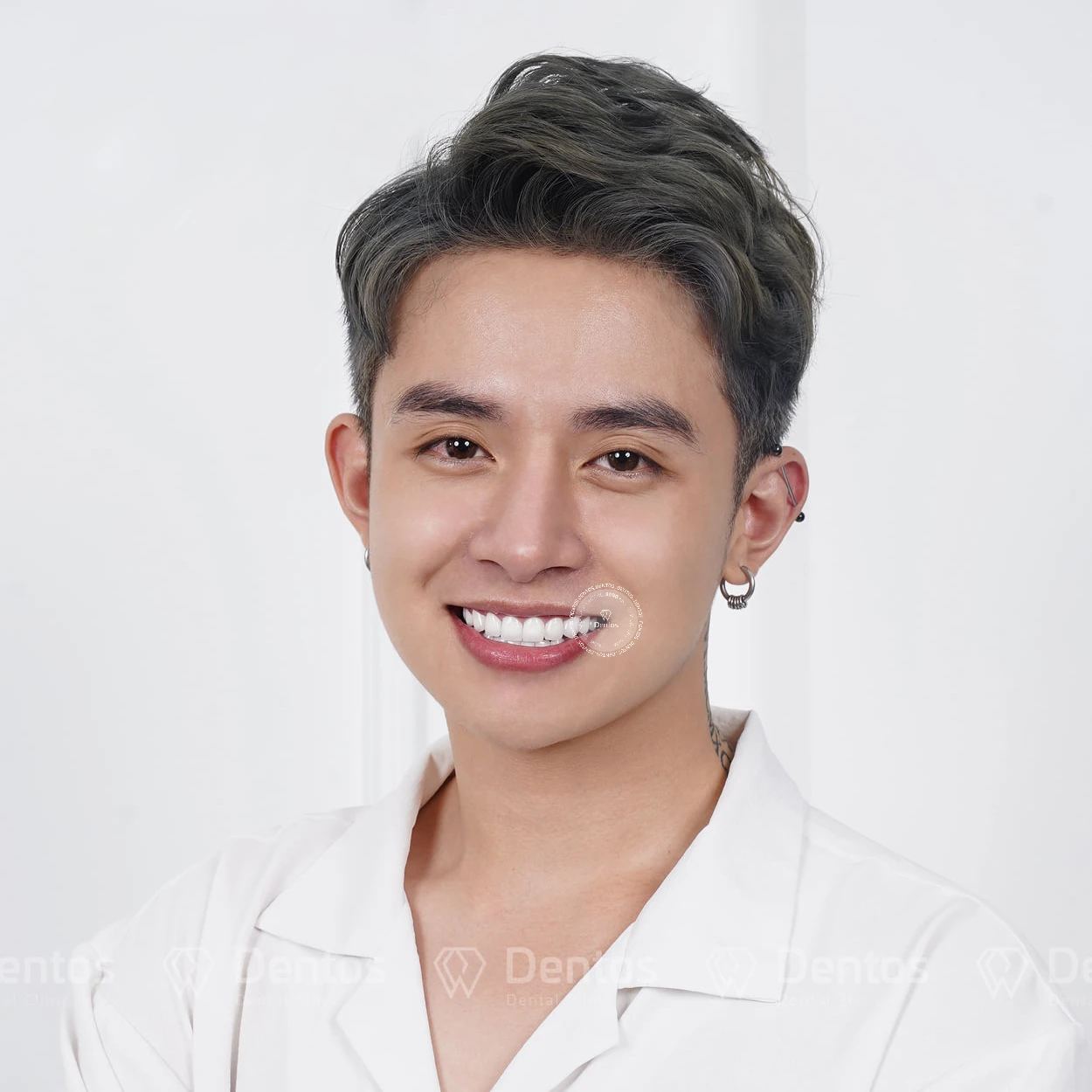 Bọc răng sứ thẩm mỹ mang lại hàm răng trắng sáng, đều đặn và hài hòa